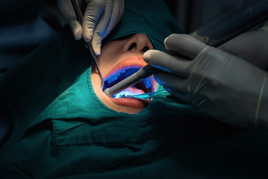 Best Oral Surgery in Ghaziabad