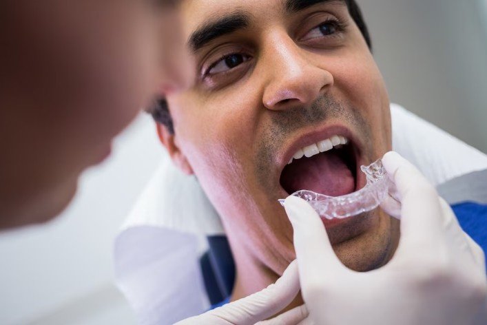 Best Mouth Guard Service in Shastri Nagar with dentist fitting a dental mouth guard for patient